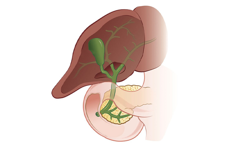 Gallbladder Cancer